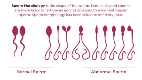 Understanding-your-Semen-Analysis-Report